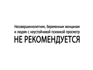 Попал под трамвай и остался жив